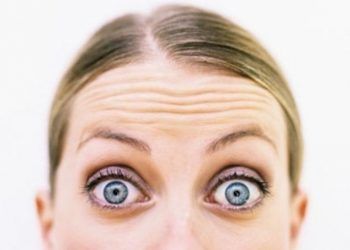 Acconciature per donne con alopecia frontale