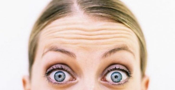 Acconciature per donne con alopecia frontale