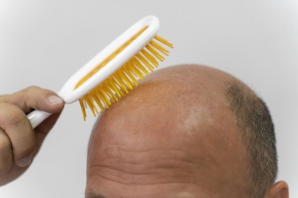 uomo che non ha capelli e cerca di pettinarci