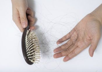 Come fermare l’alopecia?
