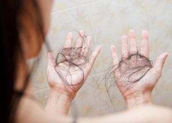 Cos'è l'alopecia da stress?
