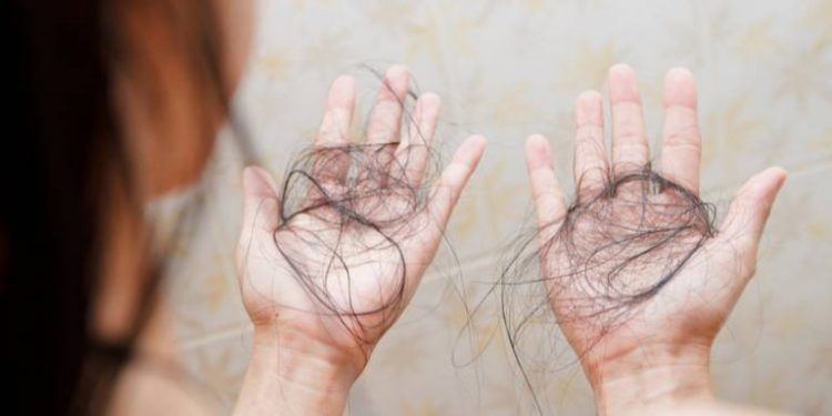 Cos'è l'alopecia da stress?