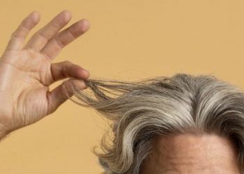 Trapianto di capelli: 10 anni dopo