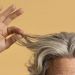 Trapianto di capelli: 10 anni dopo