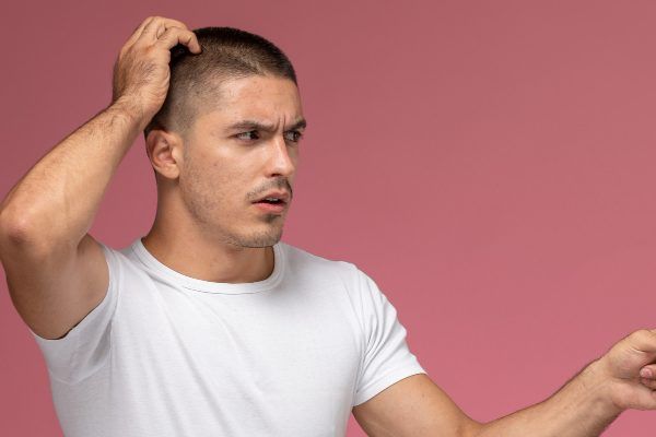 Cause della caduta dei capelli.