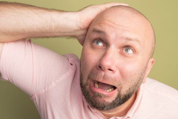 ¿Perché cadono i capelli negli uomini?