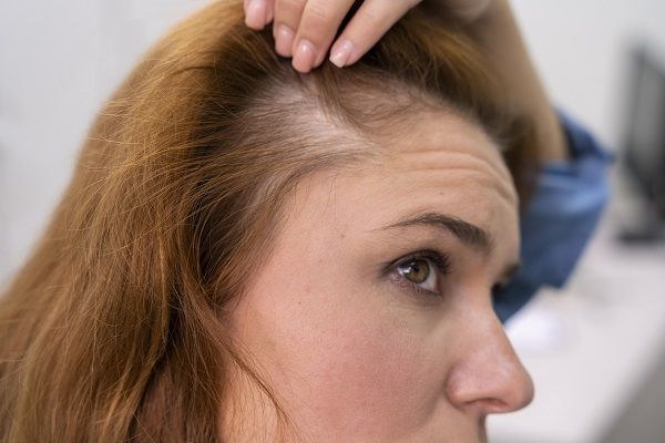 donna che si guarda allo specchio e che ha problemi di crescita dei capelli