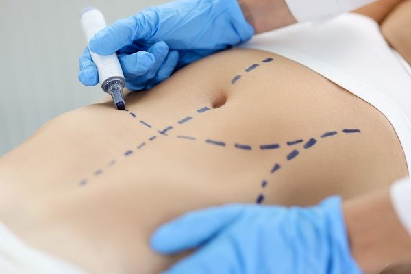Come trovare la migliore clinica di chirurgia plastica a Roma