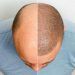 Puoi donare i capelli a qualcun altro?