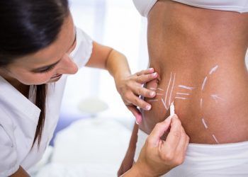 Liposcultura e liposuzione: quali sono le differenze?