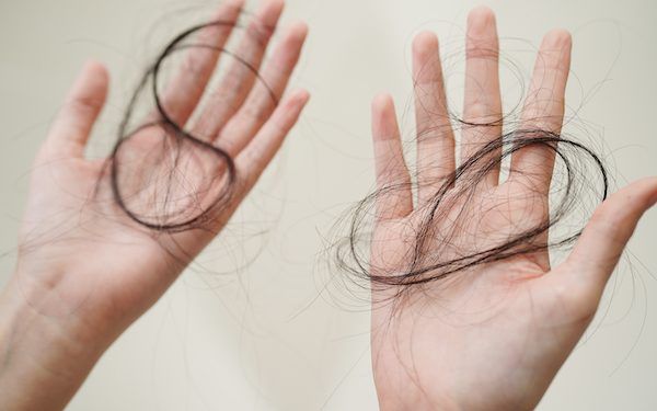 Come accelerare la ricrescita dei capelli in modo naturale