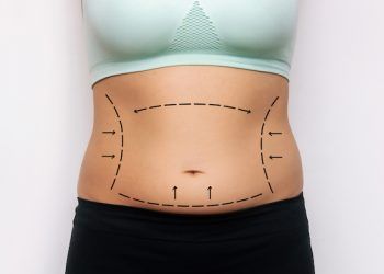 Cos’è il lipofilling e per chi è indicato?