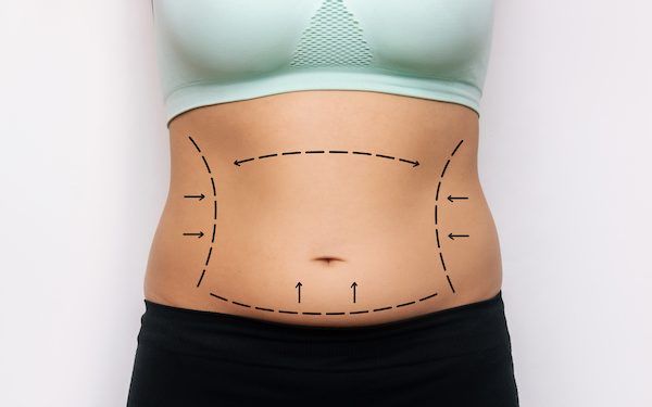 Cos’è il lipofilling e per chi è indicato?