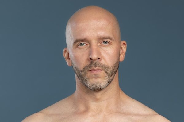 trattamento trapianto capelli uomo periodo recupero 