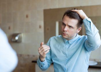 Problemi capelli degli uomini e cosa fare