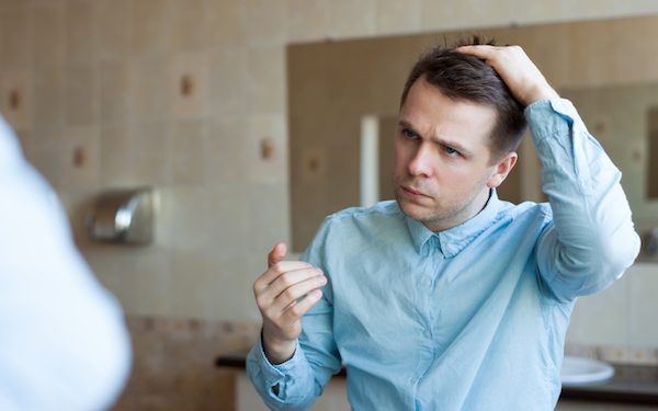Problemi capelli degli uomini e cosa fare