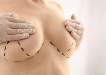 Le 10 migliori cliniche di mastoplastica in Italia