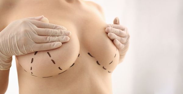 Le 10 migliori cliniche di mastoplastica in Italia