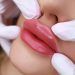 Le 10 migliori cliniche per filler labbra a Milano