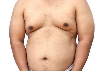 Le 10 migliori cliniche di ginecomastia a Roma