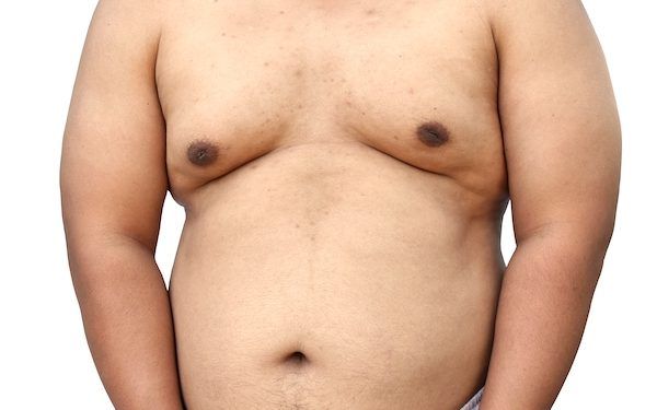 Le 10 migliori cliniche di ginecomastia a Roma