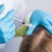Le 10 migliori cliniche per terapia PRP in Italia