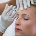 Le 10 migliori cliniche per biostimolazione a Roma