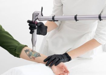 Le 10 migliori cliniche per rimuovere tatuaggi a Milano