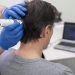 Le 10 migliori cliniche per Laser LLLT in Italia 