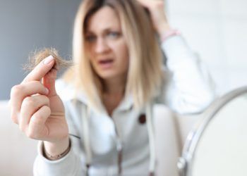 trattamenti calvizie donne