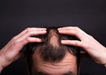 infiammazioni caduta di capelli