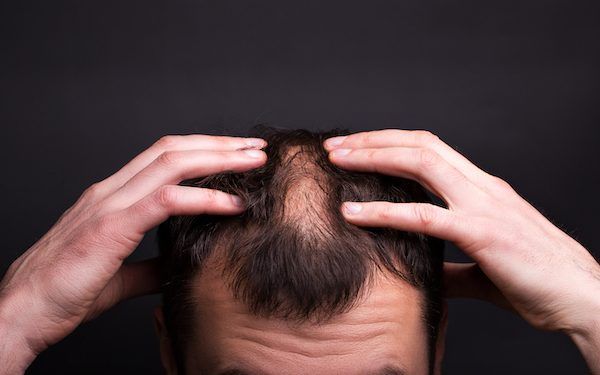 infiammazioni caduta di capelli