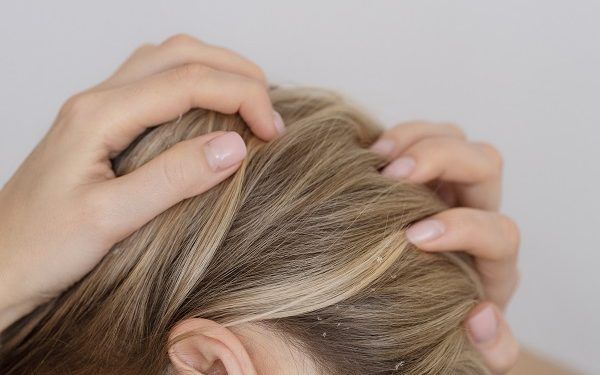 Come funzionano i shampoo antiforfora?