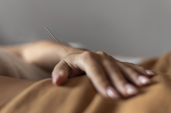 Mano de primer plano con aguja de acupuntura
