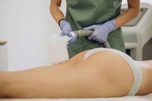 donna sottoposta a trattamento laser sulle gambe