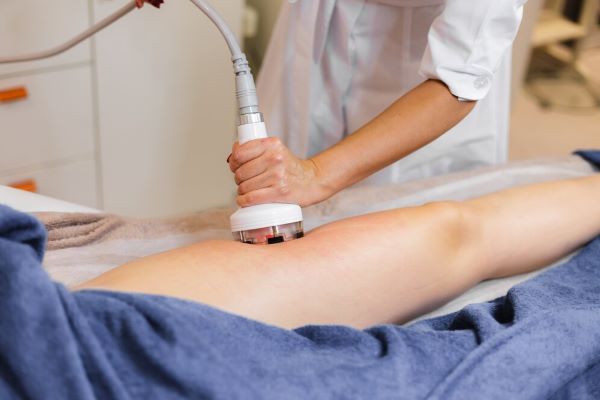 paziente sottoposta a trattamento laser sulle gambe