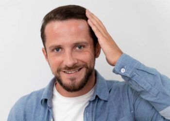 Trapianto-di-capelli-a-Roma-costi-del-trattamento-dall'inizio-alla-fine