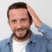 Trapianto-di-capelli-a-Roma-costi-del-trattamento-dall'inizio-alla-fine