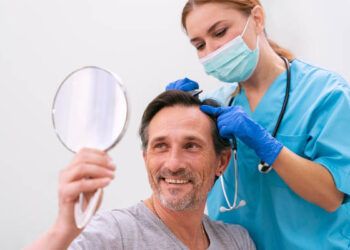 Trapianto-di- capelli-a-Roma migliori-prezzi e cliniche-per-il-2025