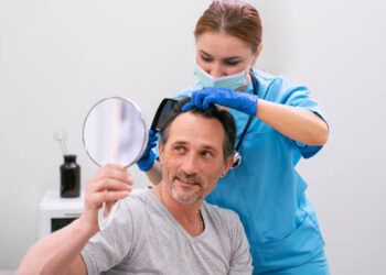 perche-il-trapianto-di-capelli-in-Italia-e-lopzione-migliore-in-Europa