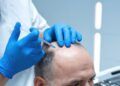 Descrizione-dettagliata-del-processo-di-trapianto-di-capelli-in-Turchia